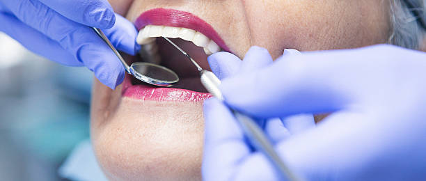 Best Chipped Tooth Repair Near Me  in Polk City, IA